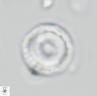 Denisea subpertusa 64014