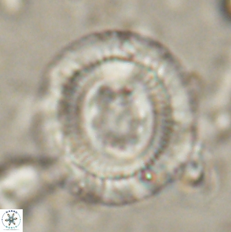 Denisea salleyi 53434