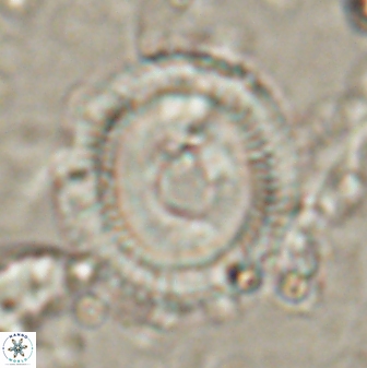 Denisea salleyi 53436
