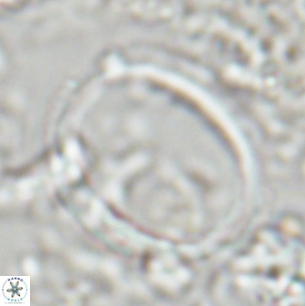 Denisea turkmenii 22407