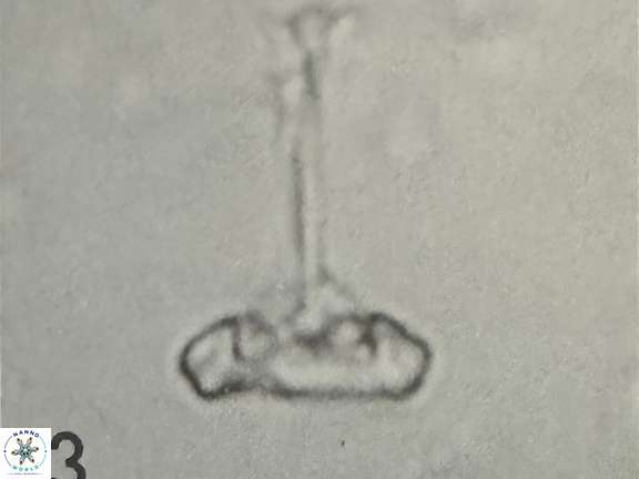 Prediscosphaera columnata 42036