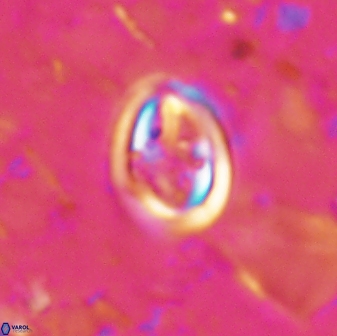 Derivanturportantes curucis 28749