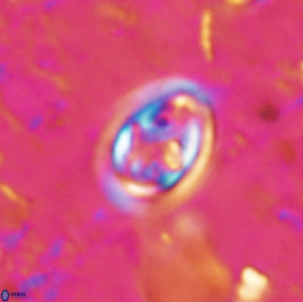 Derivanturportantes curucis 28751