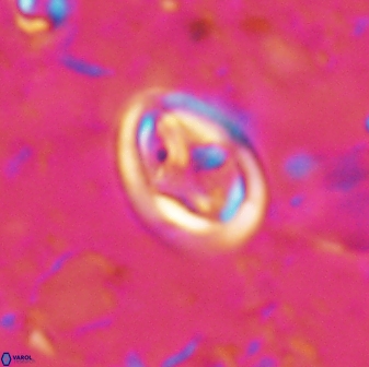 Derivanturportantes curucis 28752