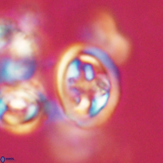 Derivanturportantes krimmenostavro 65665