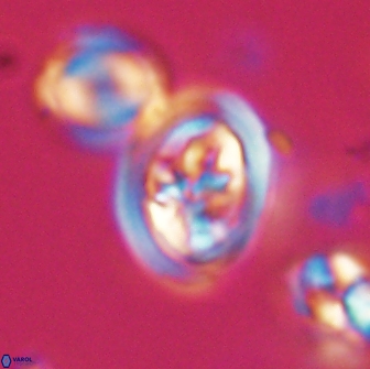 Derivanturportantes krimmenostavro 65672