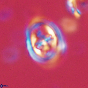 Derivanturportantes krimmenostavro 67110