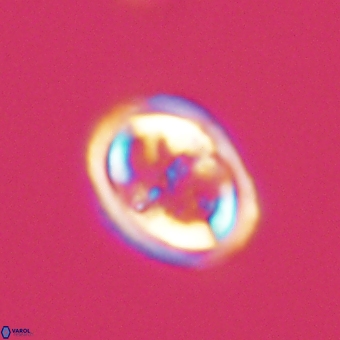 Derivanturportantes krimmenostavro 69360