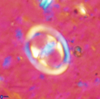 Derivanturportantes sigmoides 49699