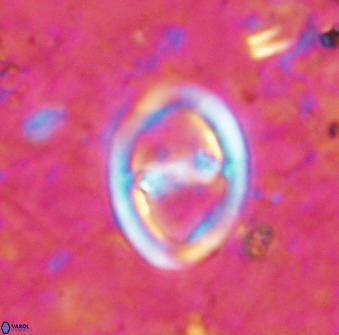 Derivanturportantes sigmoides 49700