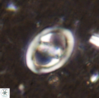 Derivanturportantes sigmoides 49702