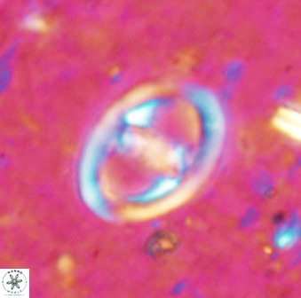 Derivanturportantes sigmoides 49703