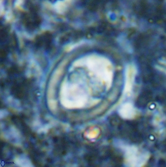 Derivanturportantes sigmoides 49704