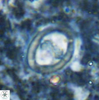 Derivanturportantes sigmoides 49704