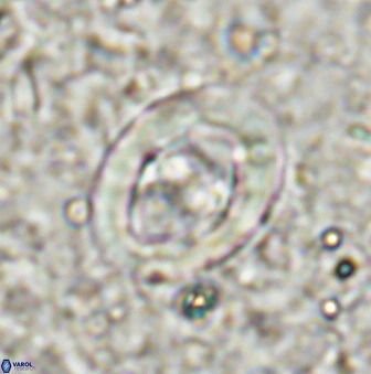 Derivanturportantes sigmoides 49706