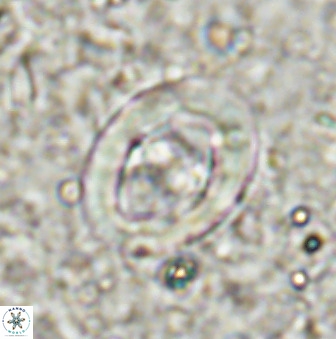 Derivanturportantes sigmoides 49706