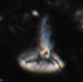 Derivanturportantes sigmoides 49978