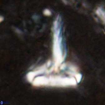 Derivanturportantes sigmoides 49979