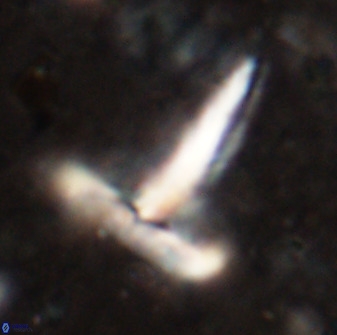 Derivanturportantes sigmoides 49987