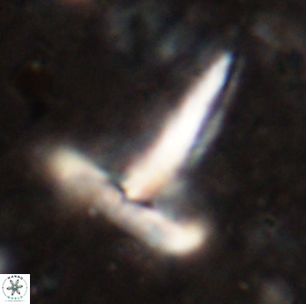 Derivanturportantes sigmoides 49987