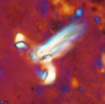 Derivanturportantes sigmoides 49991