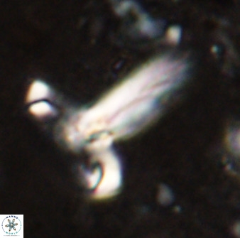 Derivanturportantes sigmoides 49993