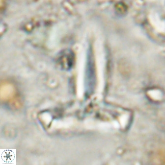 Derivanturportantes sigmoides 49994