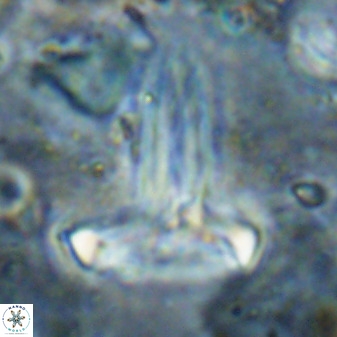 Derivanturportantes sigmoides 49995