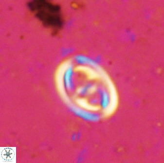 Derivanturportantes sigmoides 49904