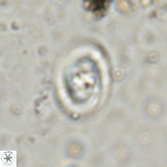 Derivanturportantes sigmoides 49908
