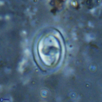 Derivanturportantes sigmoides 49911