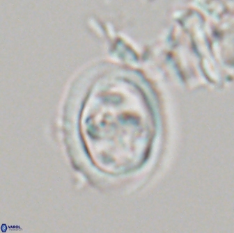 Derivanturportantes sigmoides 21140