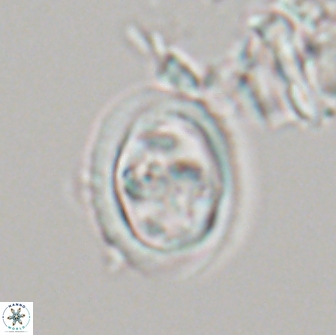 Derivanturportantes sigmoides 21140