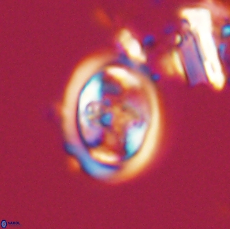 Derivanturportantes sigmoides 21133