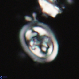 Derivanturportantes sigmoides 21135