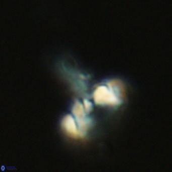 Derivanturportantes sigmoides VR 06981