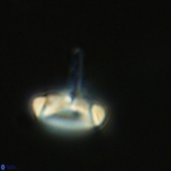 Derivanturportantes sigmoides VR 06991