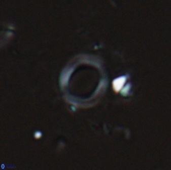 Diadelithus ellipsoides 25553