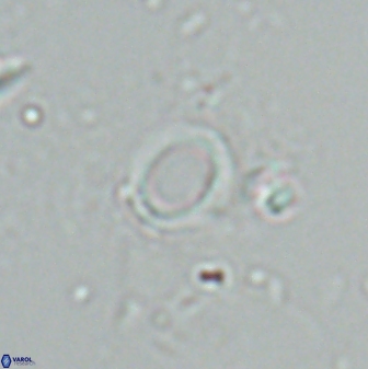 Diadelithus ellipsoides 25554