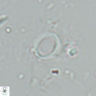Diadelithus ellipsoides 25554