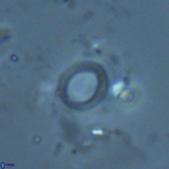 Diadelithus ellipsoides 25555