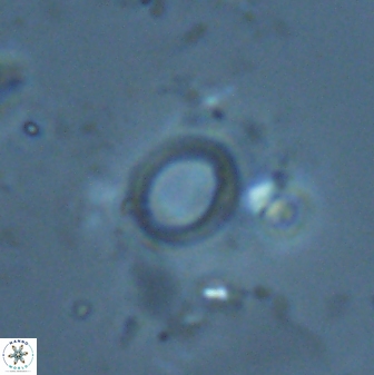Diadelithus ellipsoides 25555
