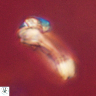 Diadelithus robustus 63212