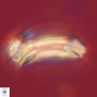 Diadelithus robustus 63213
