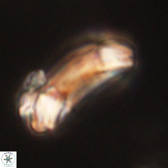 Diadelithus robustus 63215
