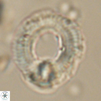 Diadelithus robustus 63222