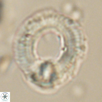 Diadelithus robustus 63223