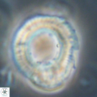 Diadelithus robustus 63224