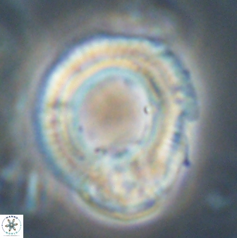 Diadelithus robustus 63225