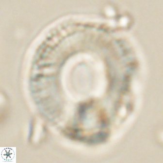 Diadelithus robustus 63226